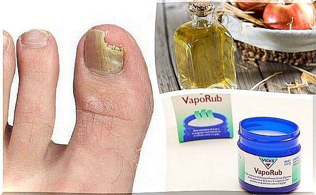 6 natural remedies against nail fungus