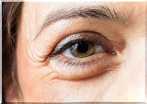 Remove dark circles with castor oil