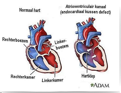 7 heart murmur symptoms you should know