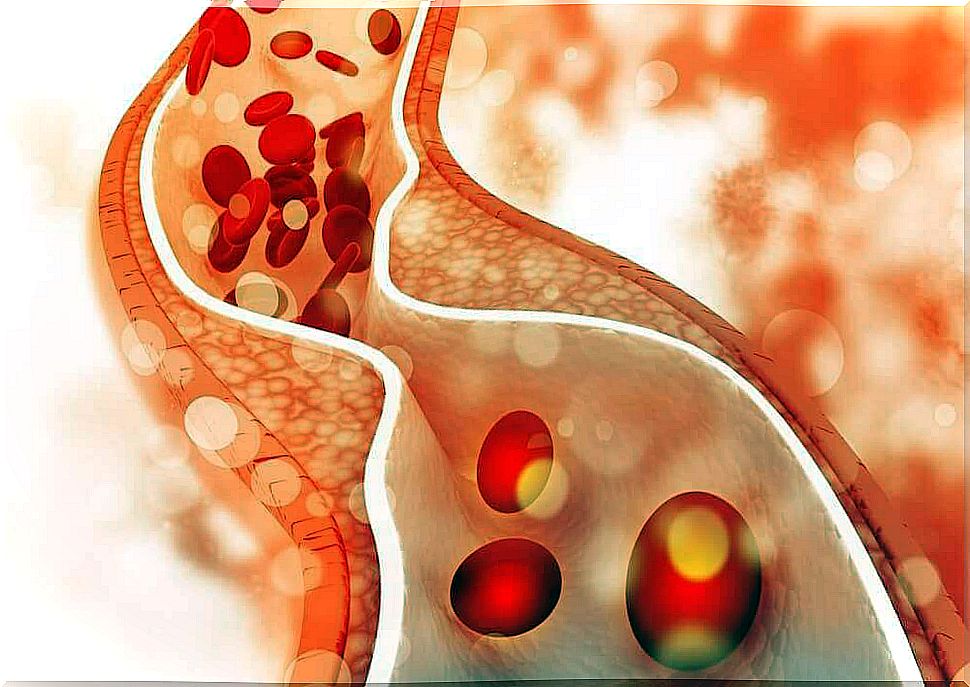 Control high levels of bad cholesterol with a healthy diet