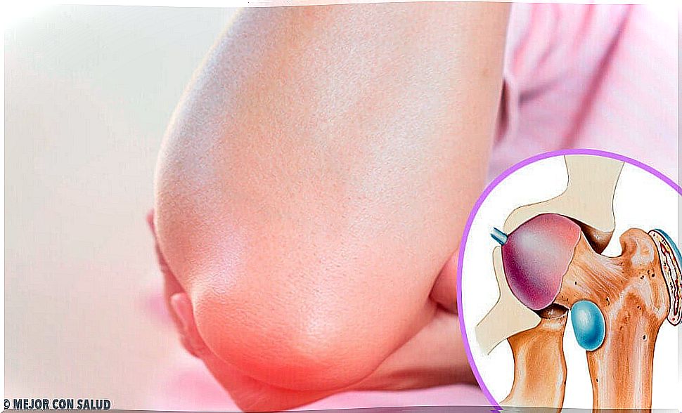 Everything you need to know about bursitis