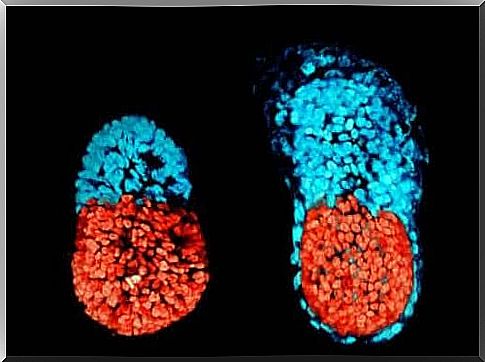 Embryo with wrong development