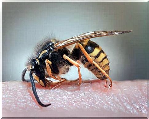 Home remedies for wasp stings