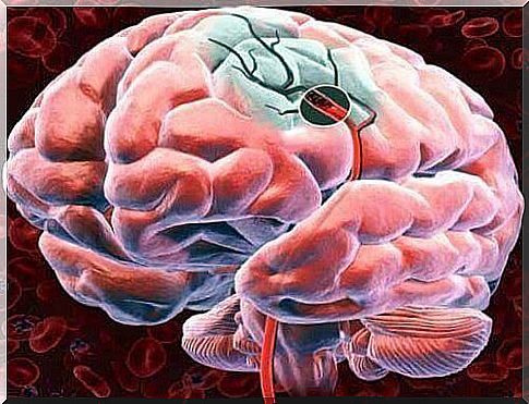 How to improve blood flow to the brain