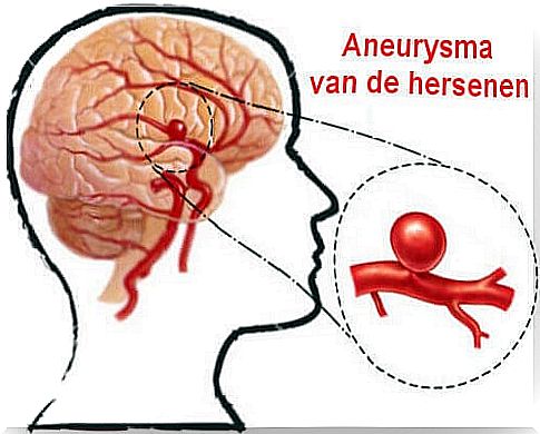 Preventing and Recognizing an Aneurysm