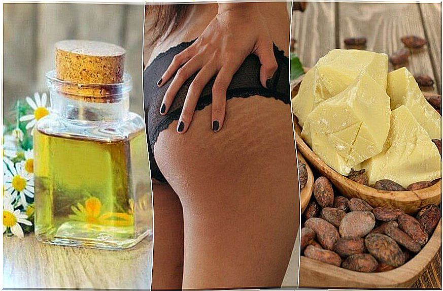 Reduce stretch marks with these 5 home remedies