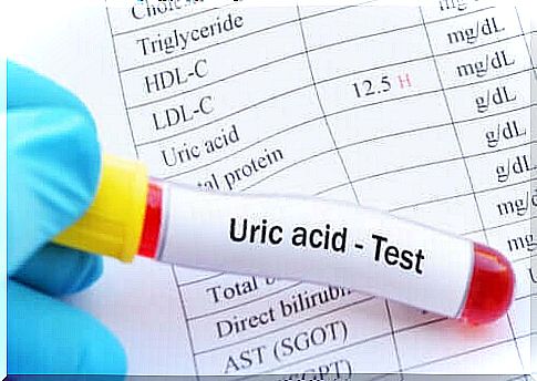 What are the consequences of high uric acid levels?